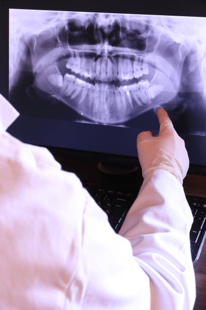 Best Tooth Infection Emergency Dentist  in Montgomery, AL
