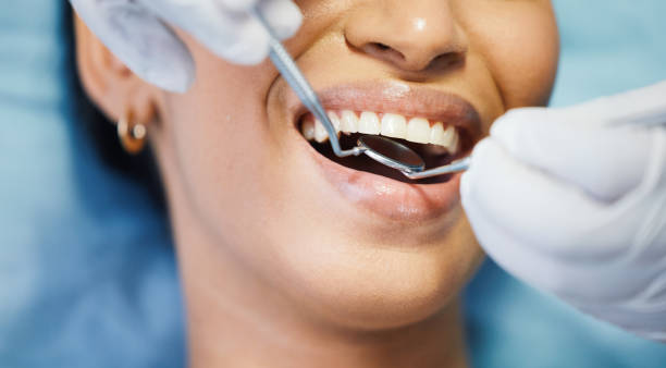 Best Teeth Whitening  in Montgomery, AL