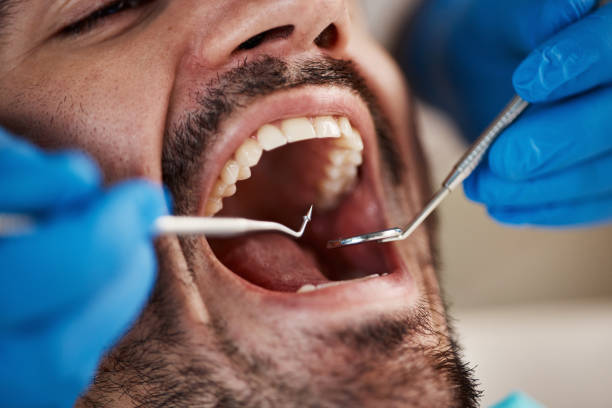 Best Emergency Tooth Extraction  in Montgomery, AL