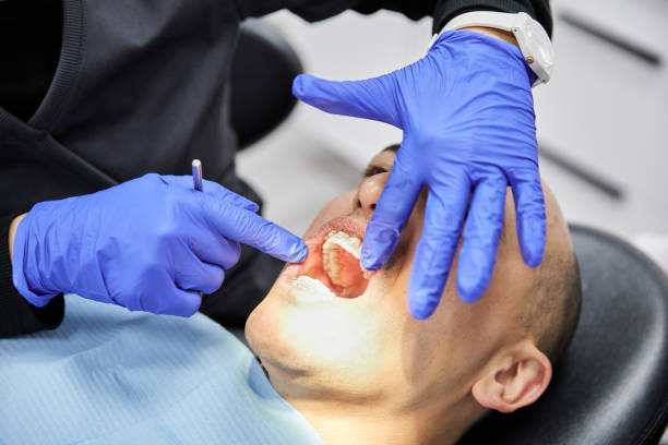 Best Root Canal Emergency Dentist  in Montgomery, AL