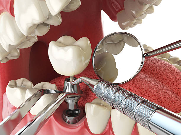 Best Tooth Infection Emergency Dentist  in Montgomery, AL